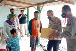 Polisi Peduli, Polres Bojonegoro Berikan Bantuan Pengobatan Bocah Cacat Sejak Lahir
